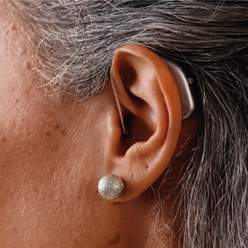woman-hearing-aids