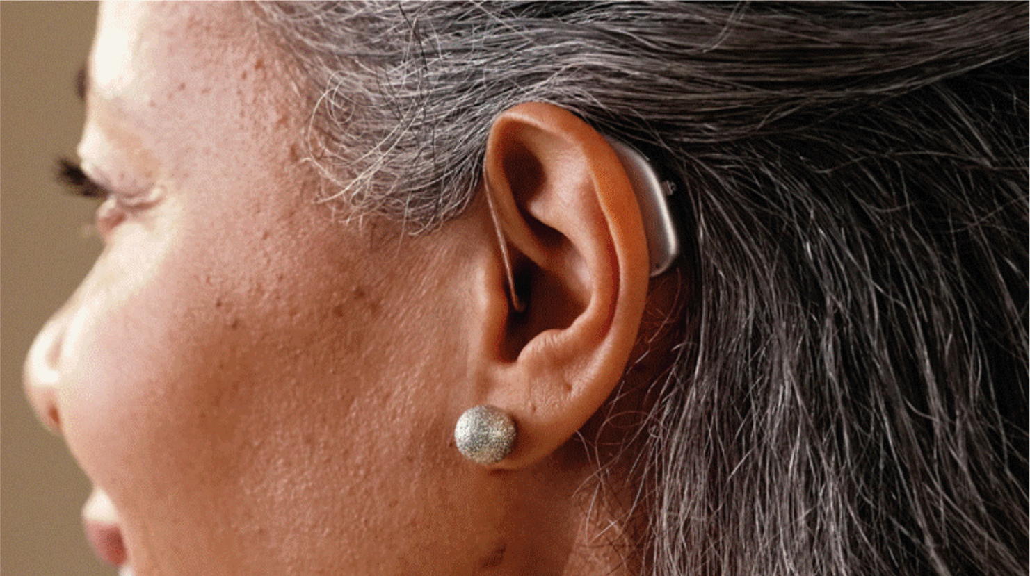 woman-hearing-aids